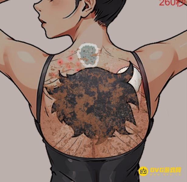 《解压找茬烧脑》第234关背部护理怎么过