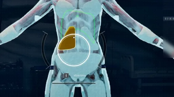 《检疫区最后一站》X光机使用攻略