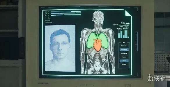 《生化危机安魂曲》二级安全识别腕带获取攻略